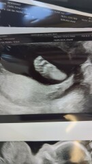 September 2024 - Thread 6! 🐣🧡💛❤️