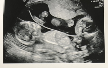 OCTOBER 2024 BABIES - Thread 4