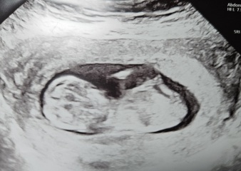 Boy or Girl:)