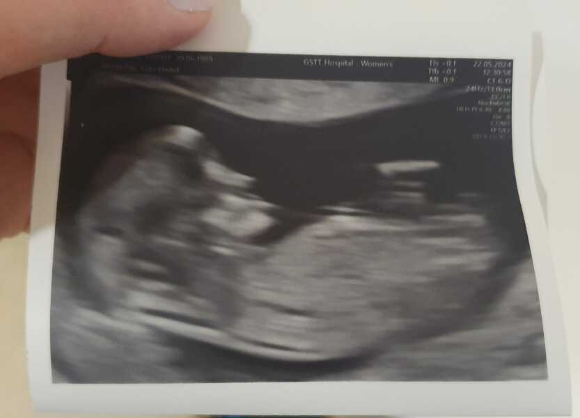 Dec-Christmas Babys 2024 part 2