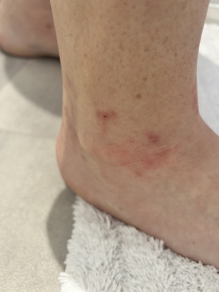 Does this look like an allergy?