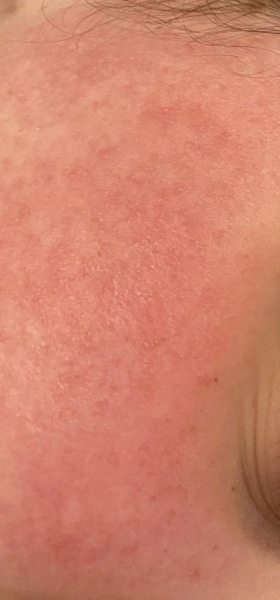 What is going on with these eyebrows?
