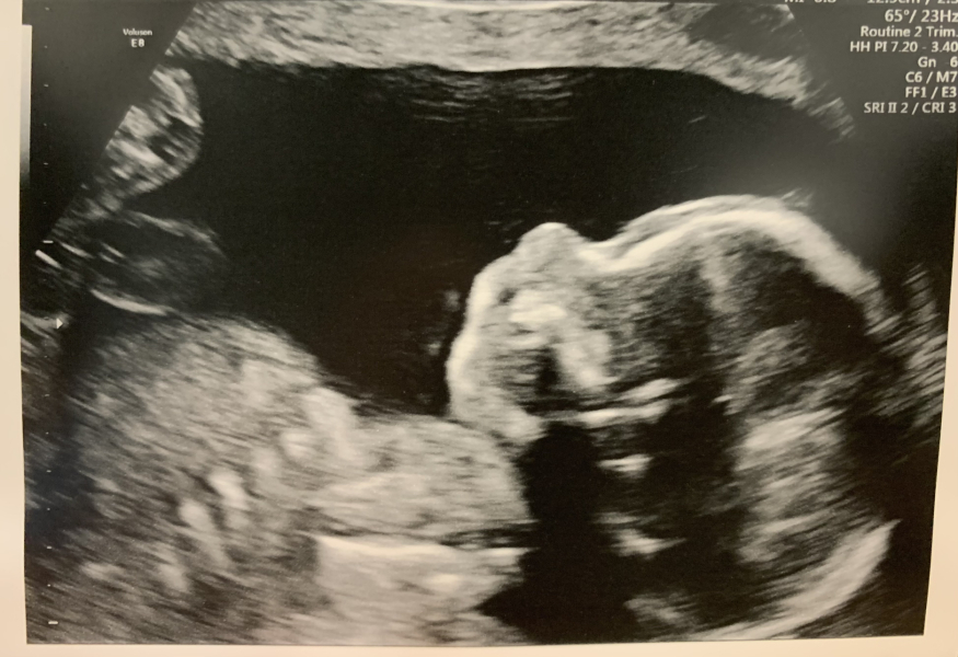 September 2024 - Thread 6! 🐣🧡💛❤️