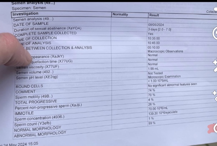 Anyone help with partners sperm test