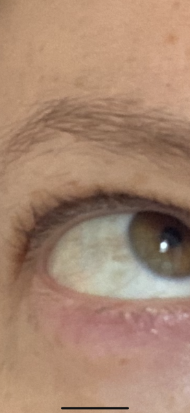 Do my eyes look a bit yellow/ brown to you