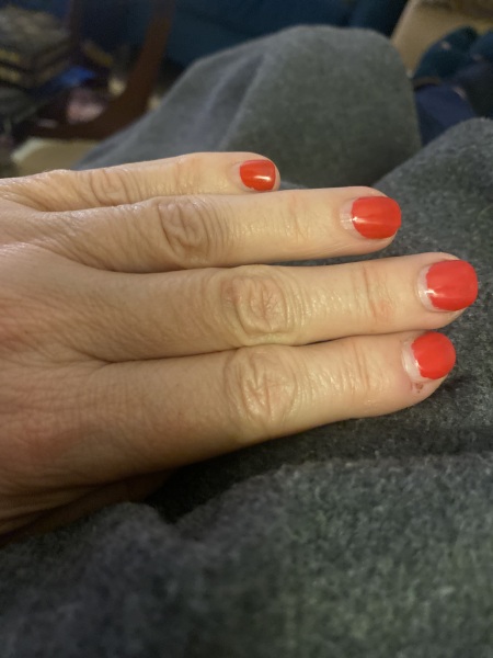 Are gels on toes a waste of money ?