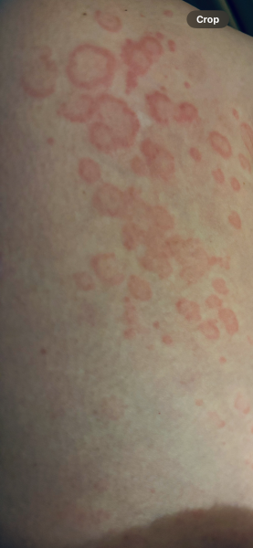 To ask your advice on allergy. Photo trigger