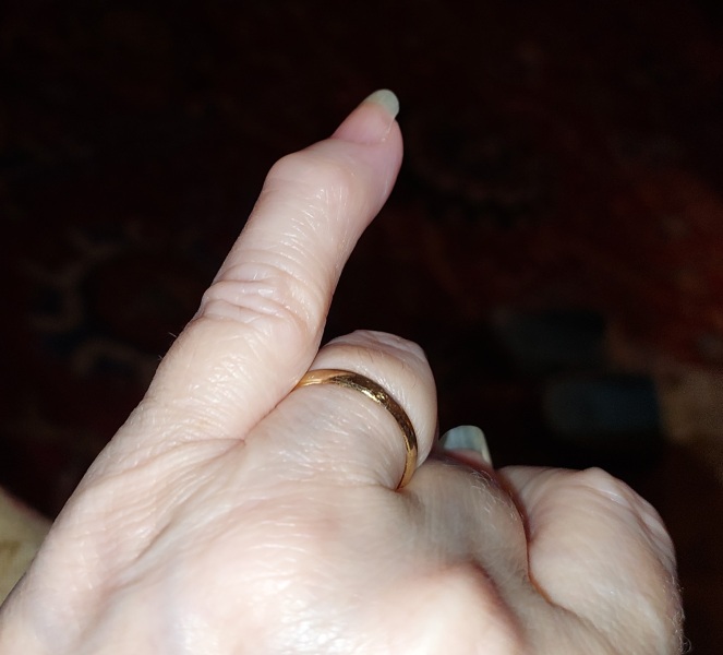 Lump on finger...ignore or gp econsult?