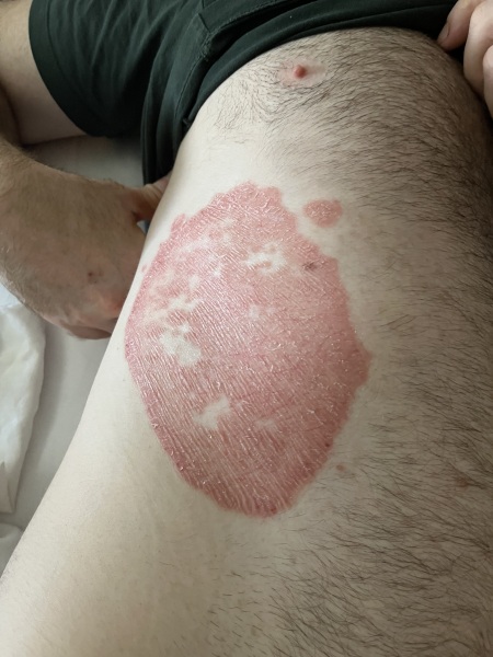 To think my BF should go to the doctor? (Warning - pics included)