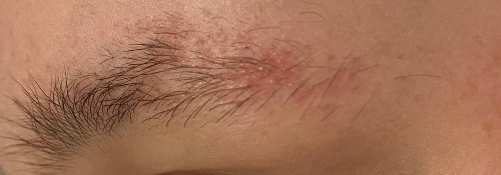 What is going on with these eyebrows?