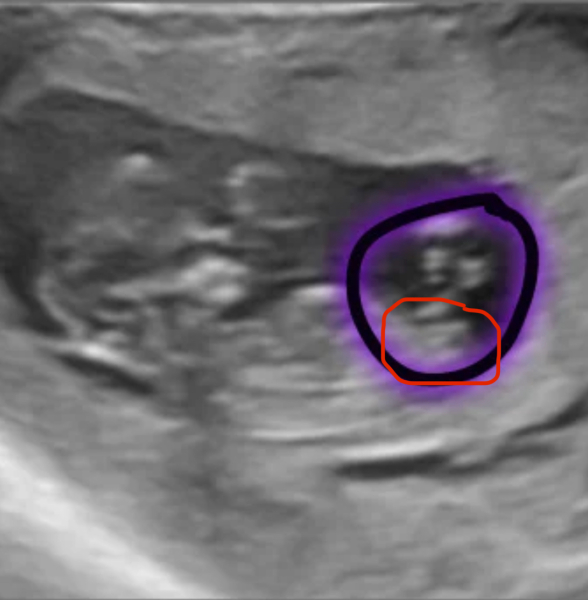 Nub theory confusion