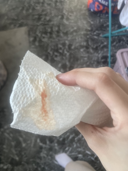 Early pregnancy bleeding ?