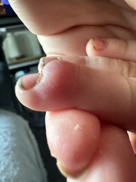 Son hurt finger