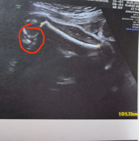 Femur shot? Gender guess please?