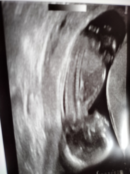 Can anyone do my nub guess?