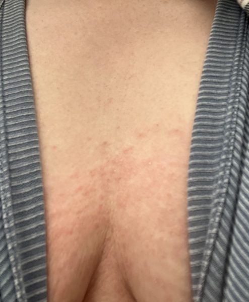 To just rip my skin off?