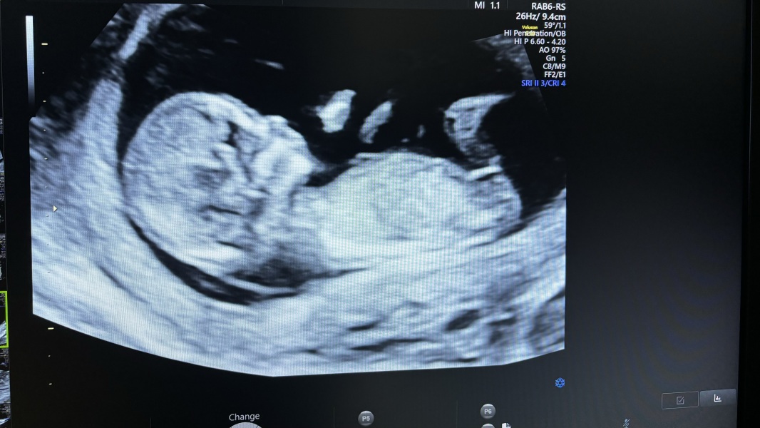 November Babies: Thread 4 (Into the Second Trimester and Beyond!)