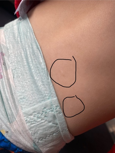 What are these lumps?!