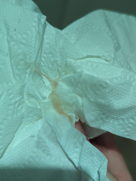 *sensitive pic* confused