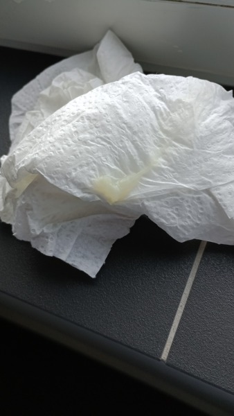 Tmi mucus plug