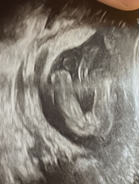 Boy or girl?