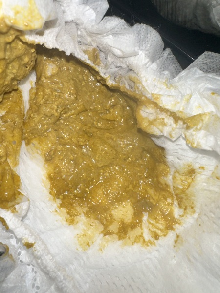 Potencial milk allergy?