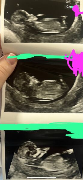 Just for fun .. girl or boy?
