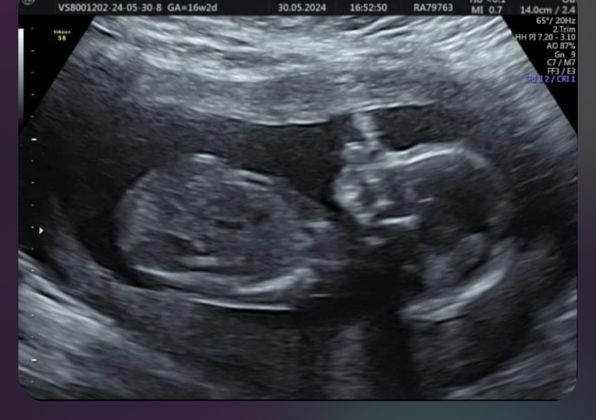 Told wrong gender at ultrasound??