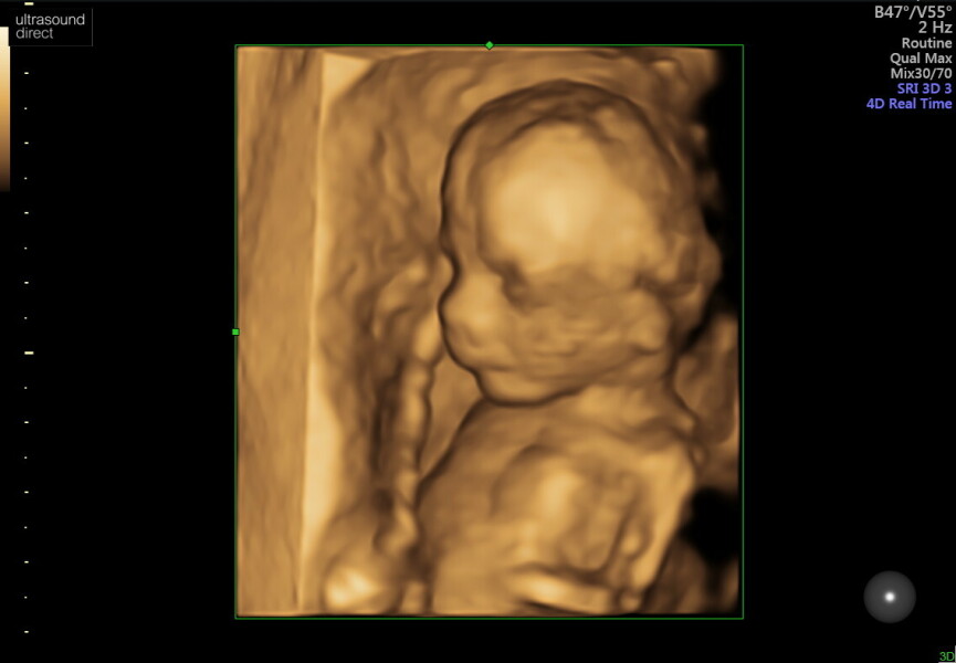 Anyone else have a weird looking 3D scan?