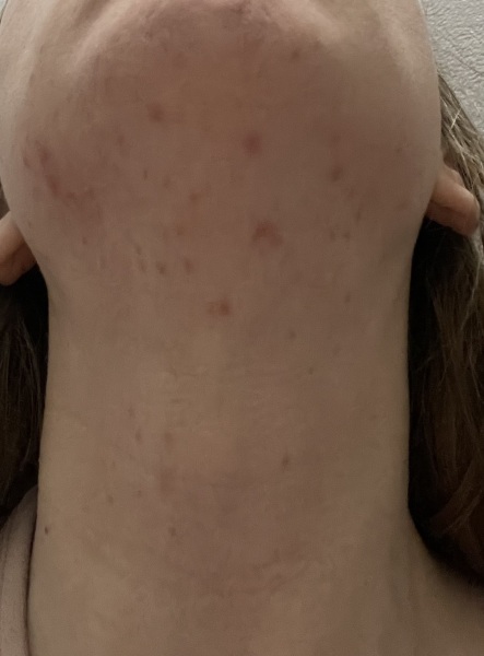 Can anyone please tell me what this rash might be? Pic included