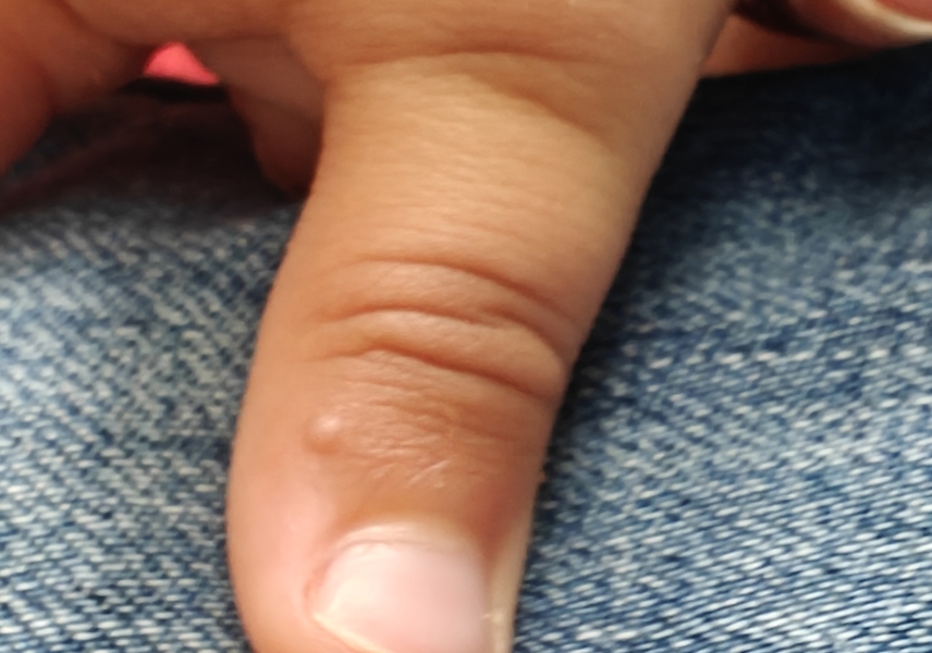 What kind of rash does this look like?