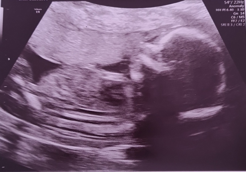 September 2024 - Thread 6! 🐣🧡💛❤️