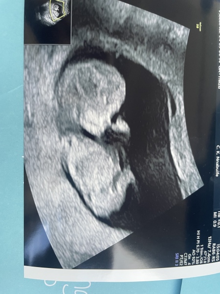 Boy or girl guess (just for fun)