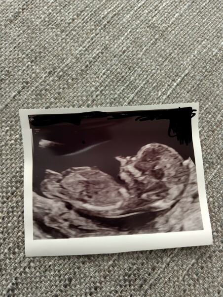 Nub theory gender guesses anyone?