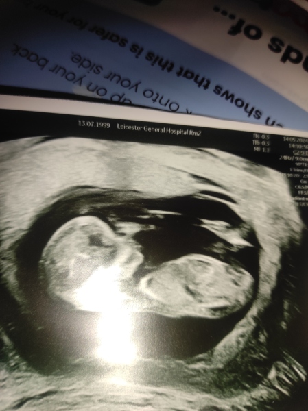 Please could anyone look at my scan for nub theory :)