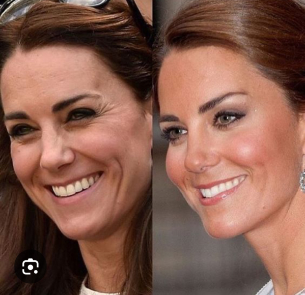 To think that botox, fillers, and other facial procedures are becoming too common?