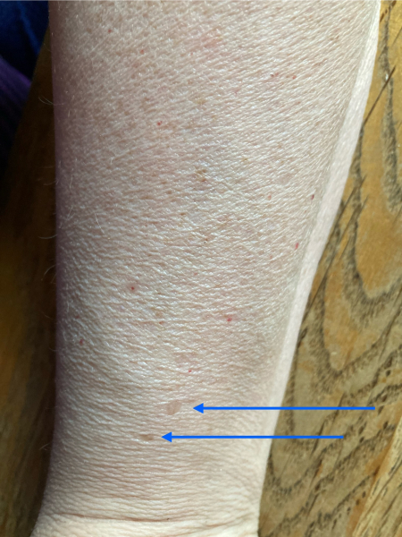 Is this something to show the doctor, or just normal aging?