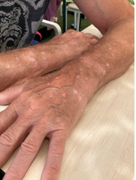 Can anyone tell me what this skin condition is please