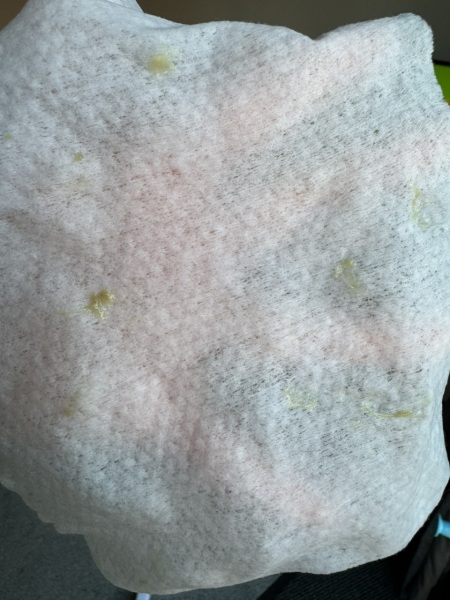 Toddler day 3 of yellow/green snot? See pics