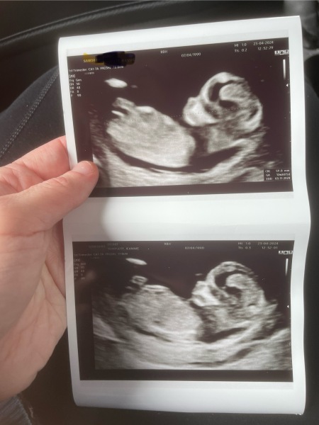 Gender guesses