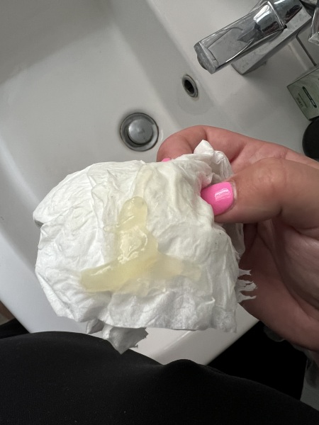 Mucus plug?!