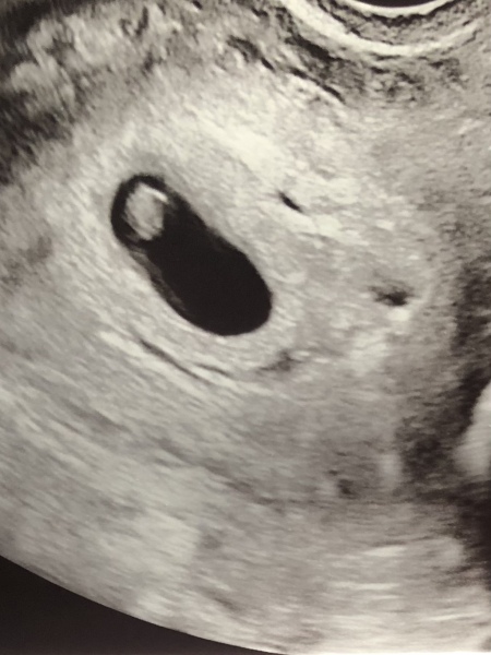 Spotting all week which I thought was my period but I’m pregnant?