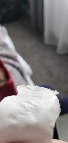 Blackhead Strip Results!