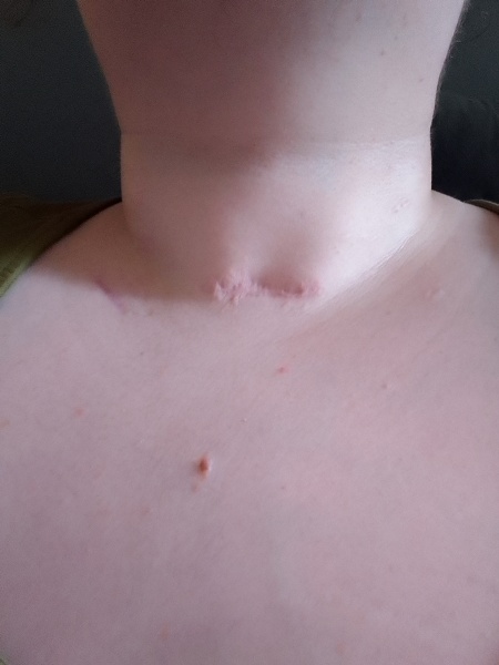 How old is my neck??