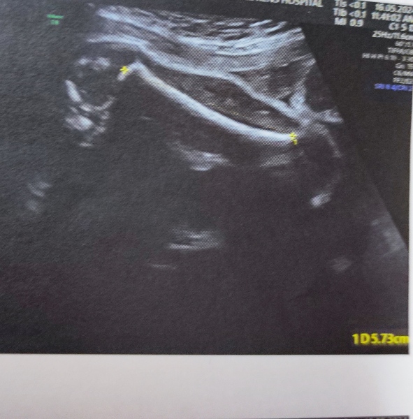 Femur shot? Gender guess please?