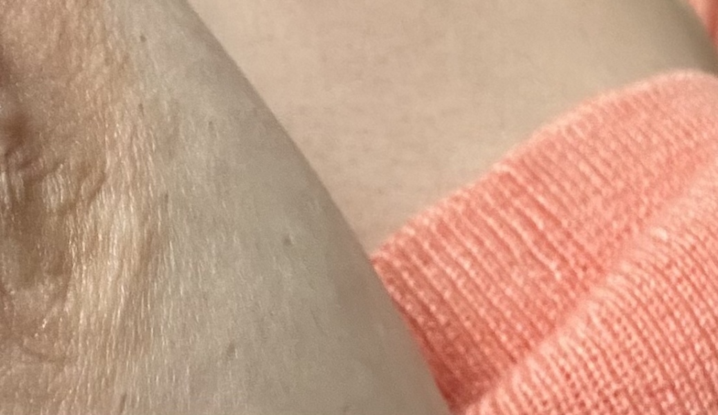 Can anyone help, does this look suspicious?? Breast