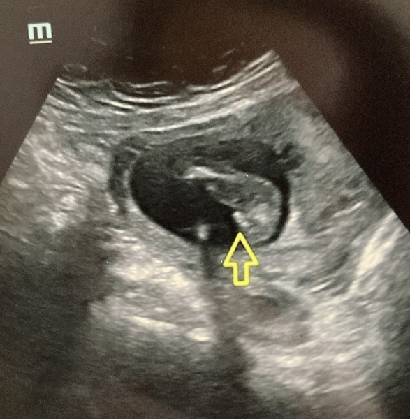 Gender scan wrong?
