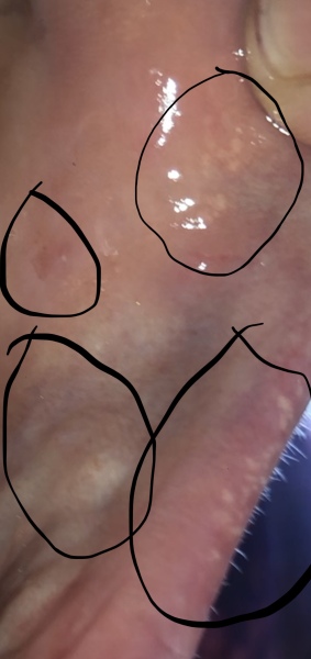 Does my cheek look concerning