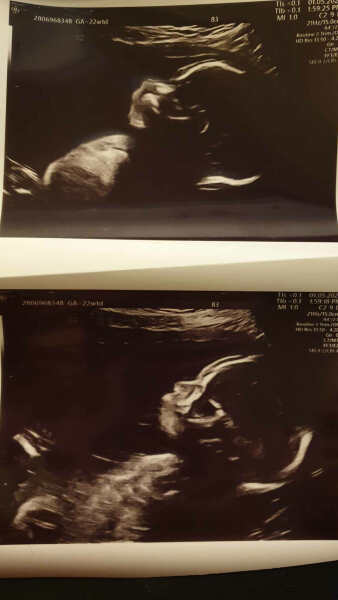 September 2024 - Thread 6! 🐣🧡💛❤️