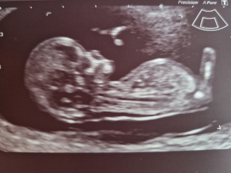 November Babies: Thread 4 (Into the Second Trimester and Beyond!)